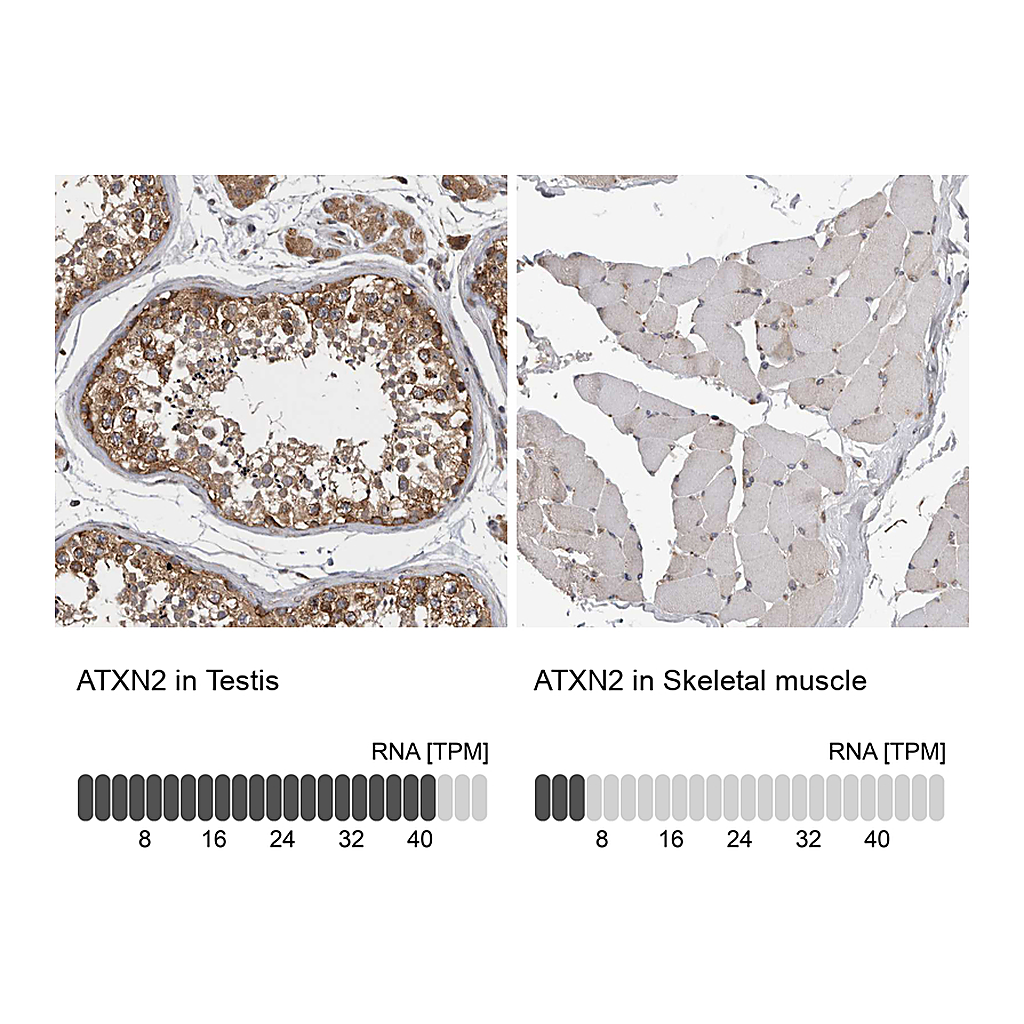 Atlas Antibodies Anti-ATXN2 Antibody
