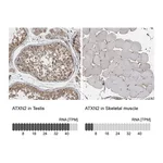 Atlas Antibodies Anti-ATXN2 Antibody