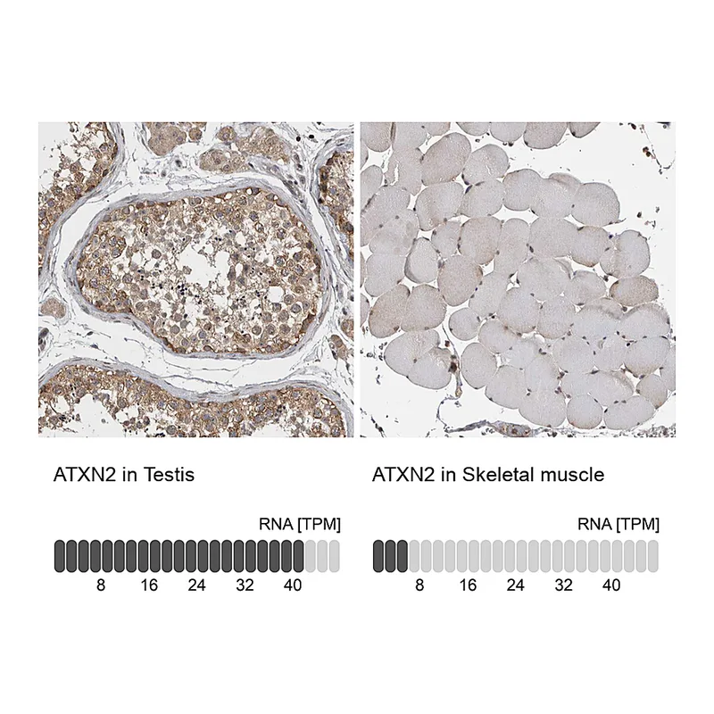 Atlas Antibodies Anti-ATXN2 Antibody