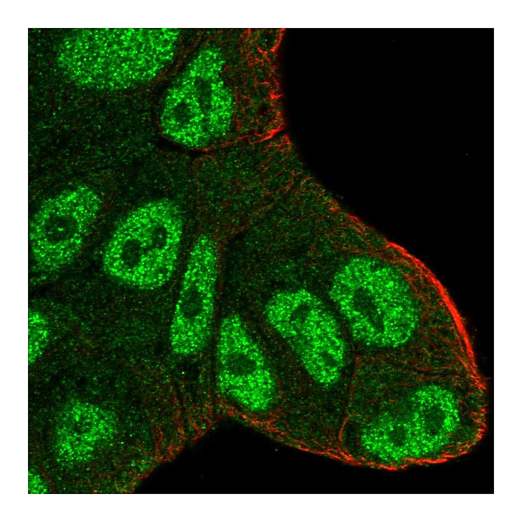 Atlas Antibodies Anti-ATXN1 Antibody
