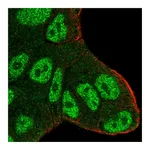 Atlas Antibodies Anti-ATXN1 Antibody