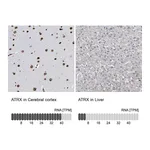 Atlas Antibodies Anti-ATRX Antibody