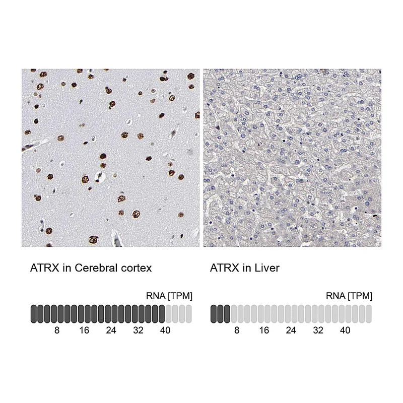 Atlas Antibodies Anti-ATRX Antibody