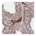 Atlas Antibodies Anti-ATXN2L Antibody