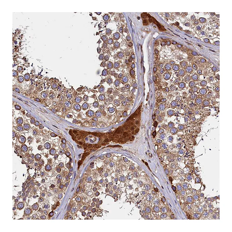 Atlas Antibodies Anti-ATXN2L Antibody