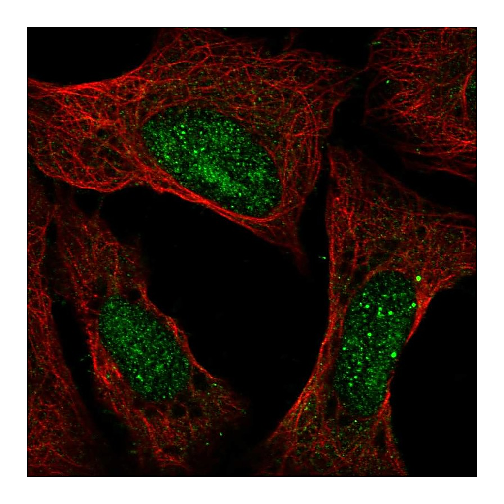 Atlas Antibodies Anti-ATXN3 Antibody