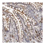 Atlas Antibodies Anti-ATXN3L Antibody