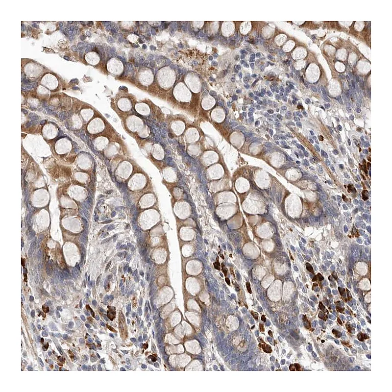 Atlas Antibodies Anti-ATXN3L Antibody