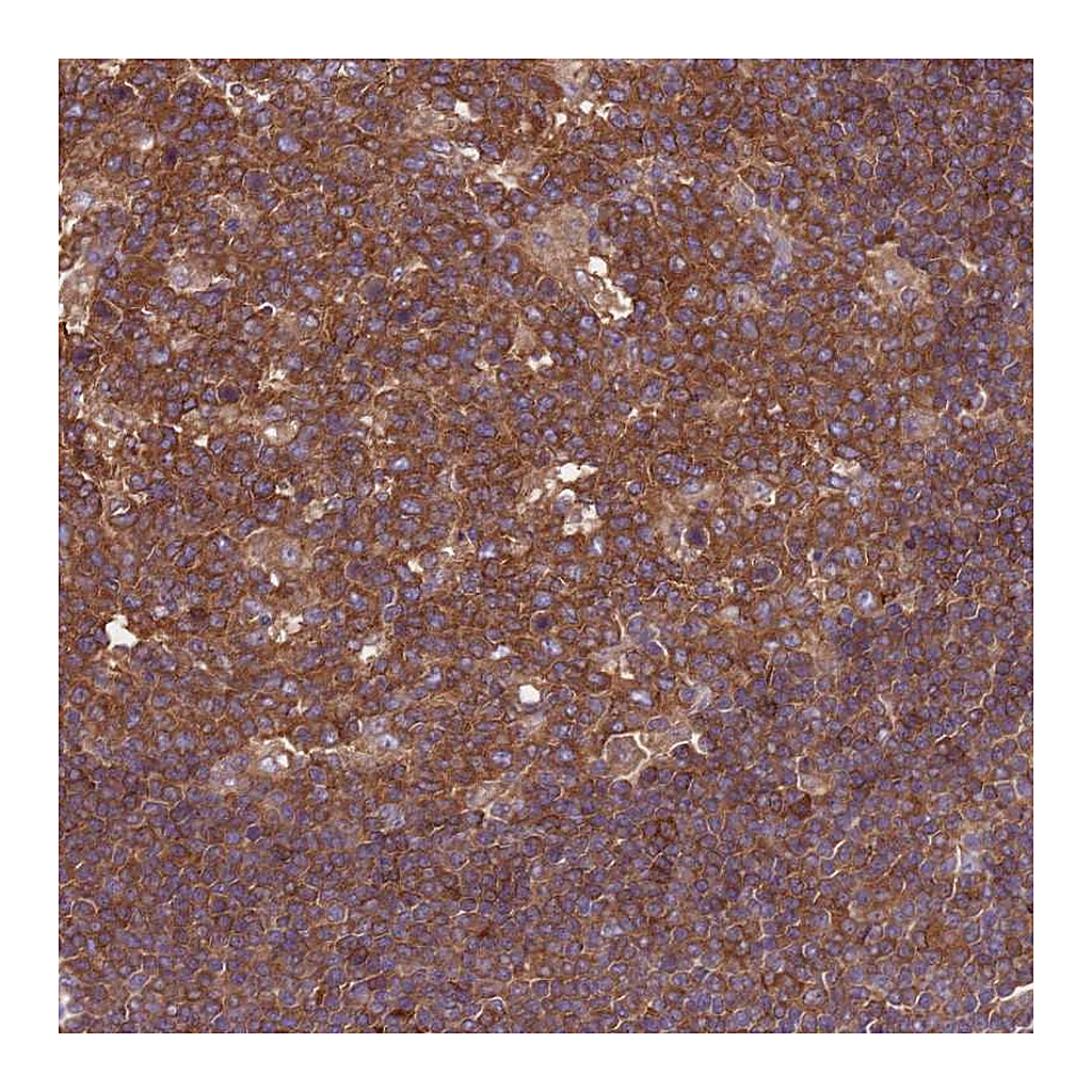 Atlas Antibodies Anti-ATXN2L Antibody