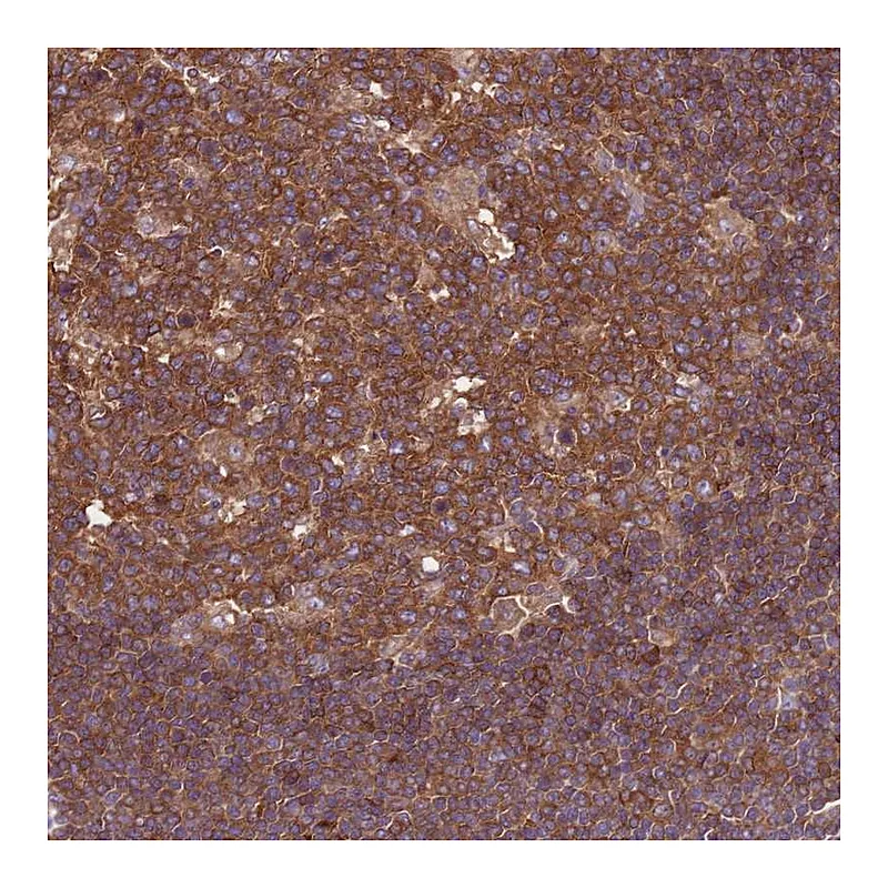 Atlas Antibodies Anti-ATXN2L Antibody