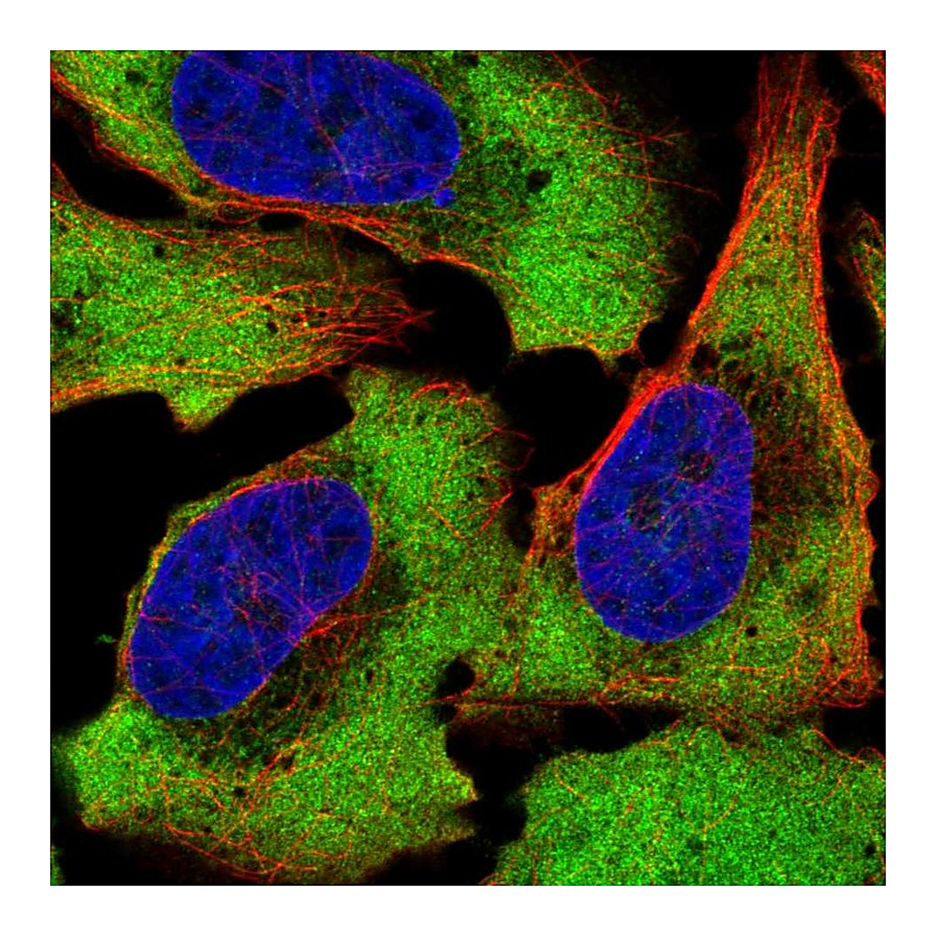 Atlas Antibodies Anti-ATXN2L Antibody