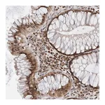 Atlas Antibodies Anti-ATXN7L1 Antibody