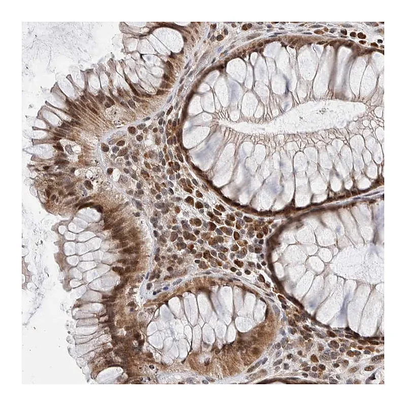Atlas Antibodies Anti-ATXN7L1 Antibody