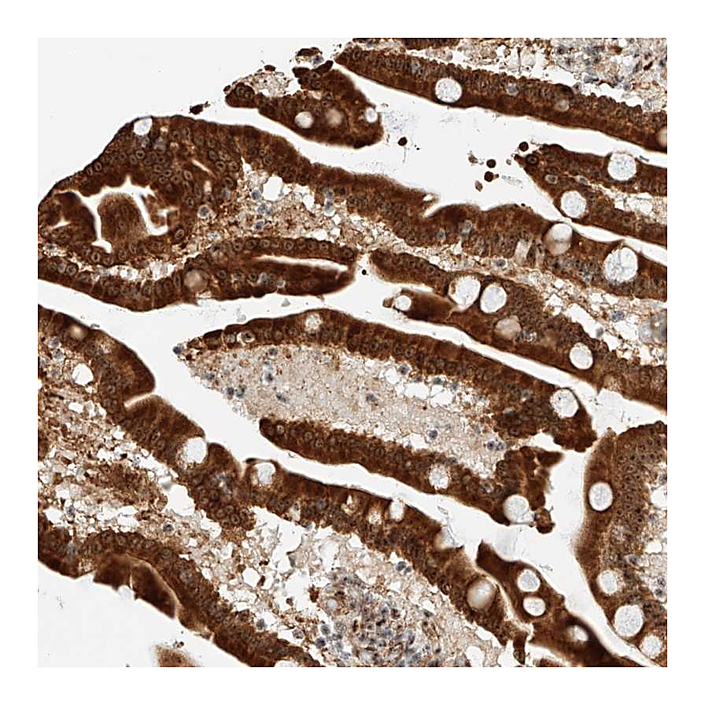 Atlas Antibodies Anti-ATXN7L2 Antibody
