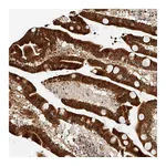 Atlas Antibodies Anti-ATXN7L2 Antibody