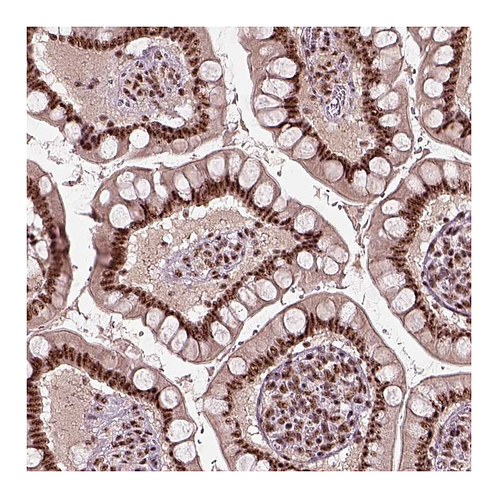 Atlas Antibodies Anti-ATXN7L3 Antibody
