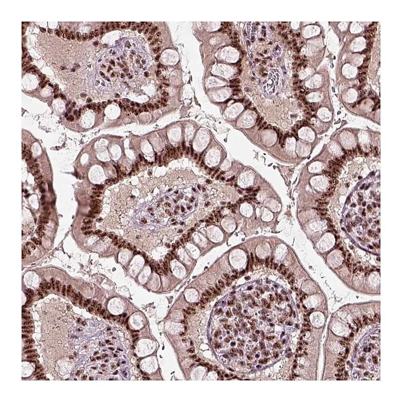 Atlas Antibodies Anti-ATXN7L3 Antibody