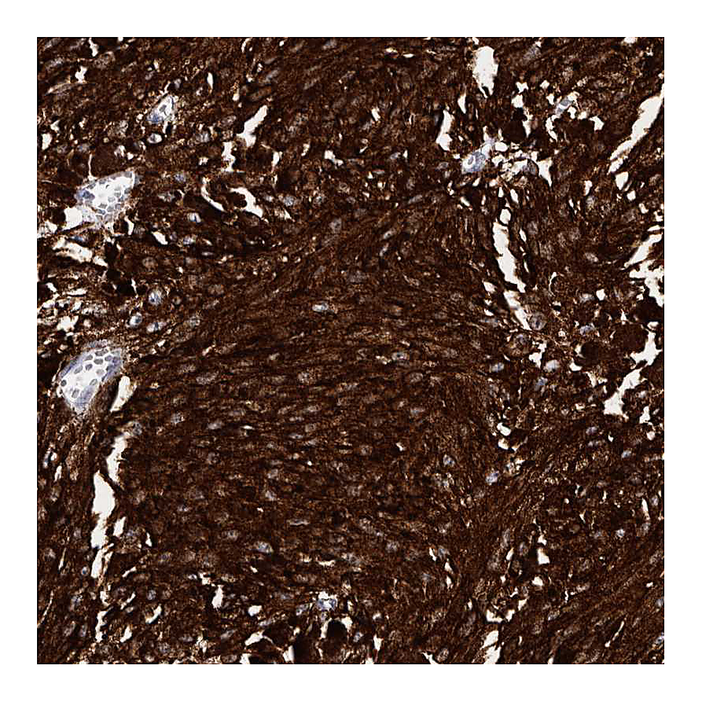 Atlas Antibodies Anti-AUNIP Antibody