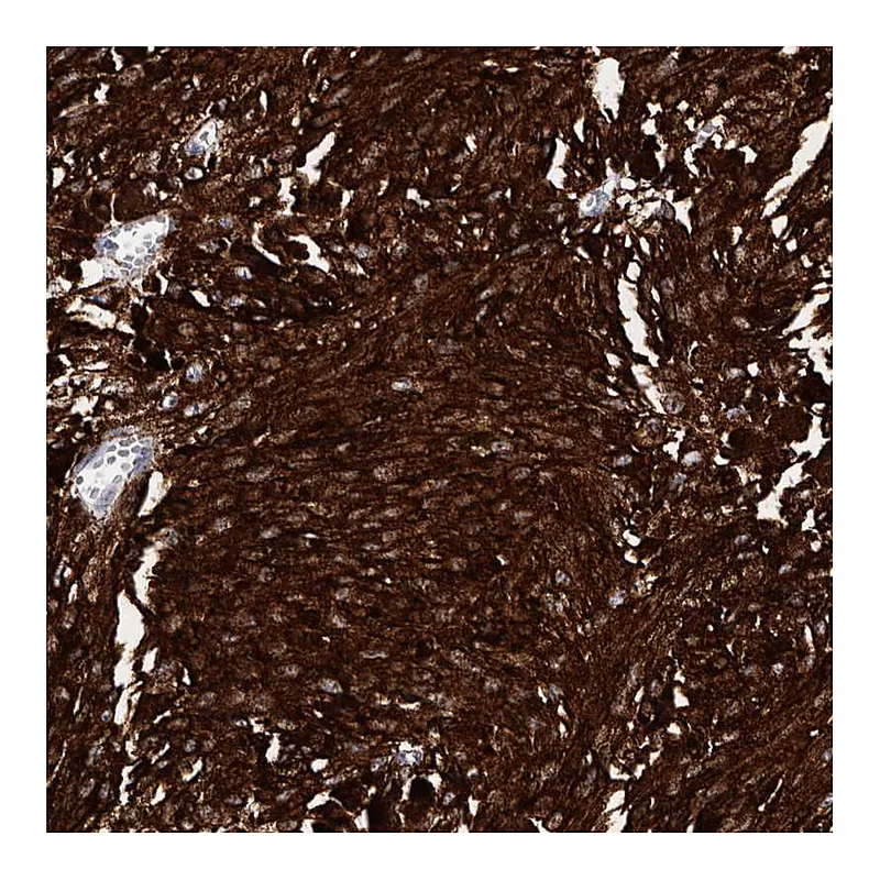 Atlas Antibodies Anti-AUNIP Antibody