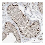 Atlas Antibodies Anti-AURKAIP1 Antibody
