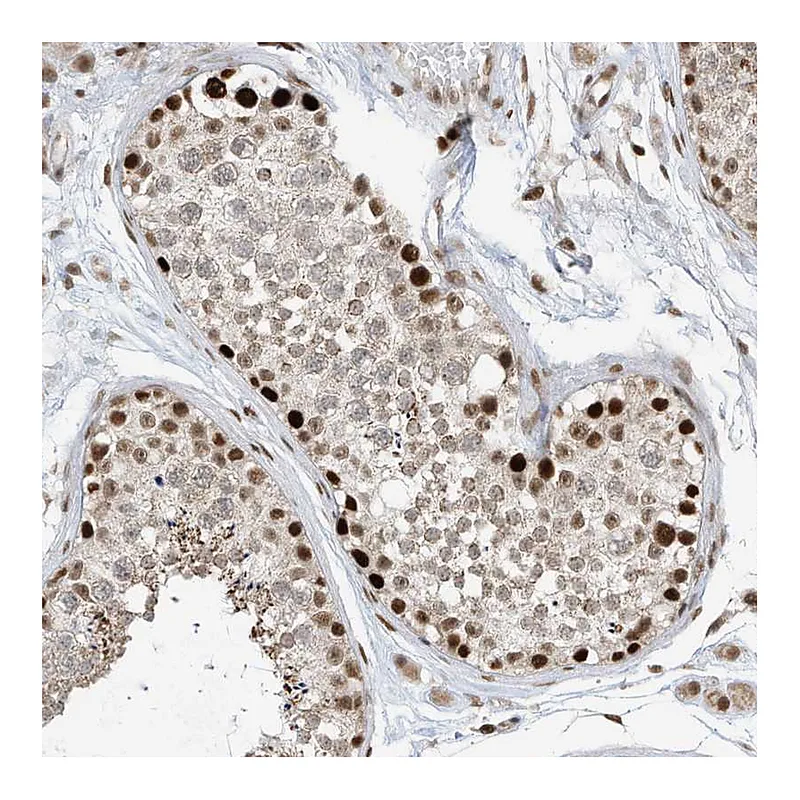 Atlas Antibodies Anti-AURKAIP1 Antibody