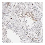 Atlas Antibodies Anti-AURKA Antibody