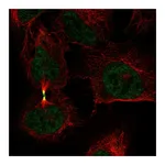 Atlas Antibodies Anti-AURKB Antibody