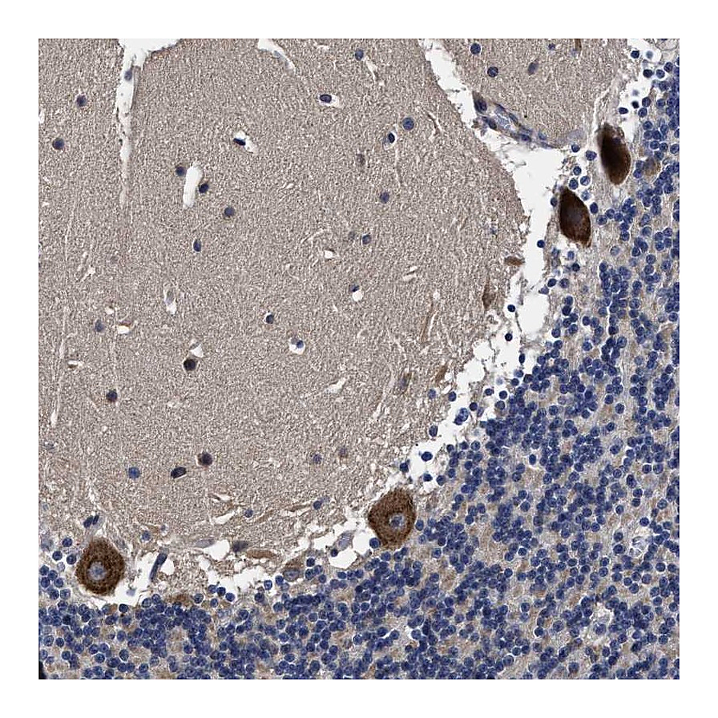 Atlas Antibodies Anti-AVEN Antibody