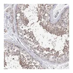 Atlas Antibodies Anti-AURKC Antibody
