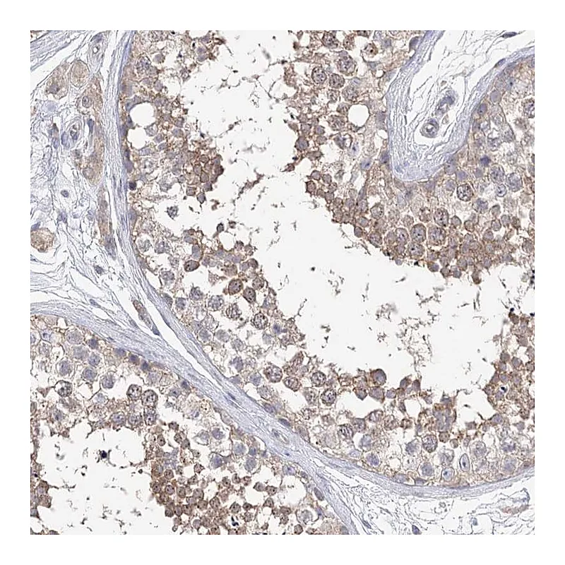 Atlas Antibodies Anti-AURKC Antibody