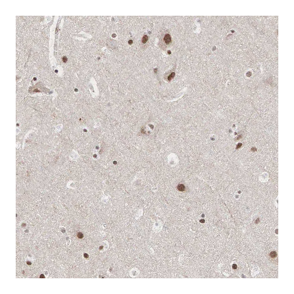 Atlas Antibodies Anti-AUTS2 Antibody