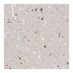 Atlas Antibodies Anti-AUTS2 Antibody