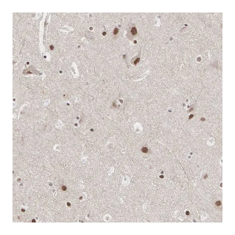 Atlas Antibodies Anti-AUTS2 Antibody