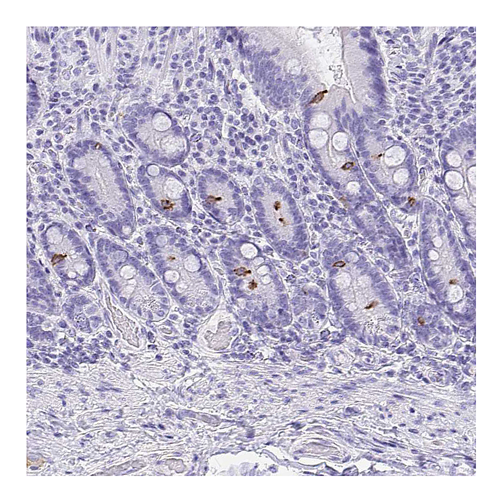Atlas Antibodies Anti-AVIL Antibody