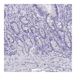Atlas Antibodies Anti-AVIL Antibody