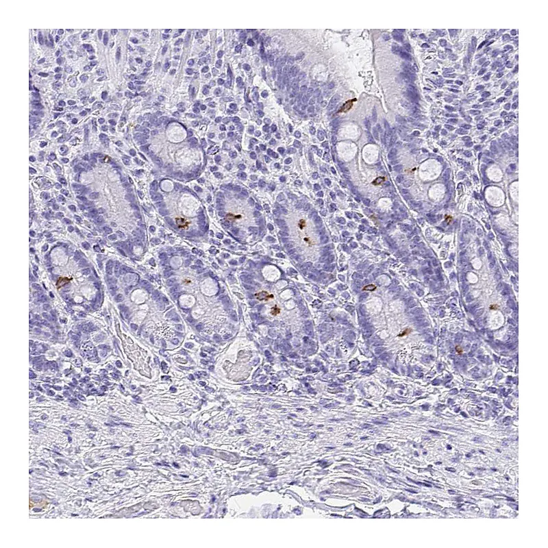Atlas Antibodies Anti-AVIL Antibody