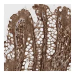 Atlas Antibodies Anti-AVPI1 Antibody