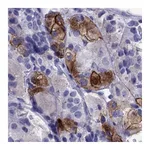 Atlas Antibodies Anti-AVPR1B Antibody
