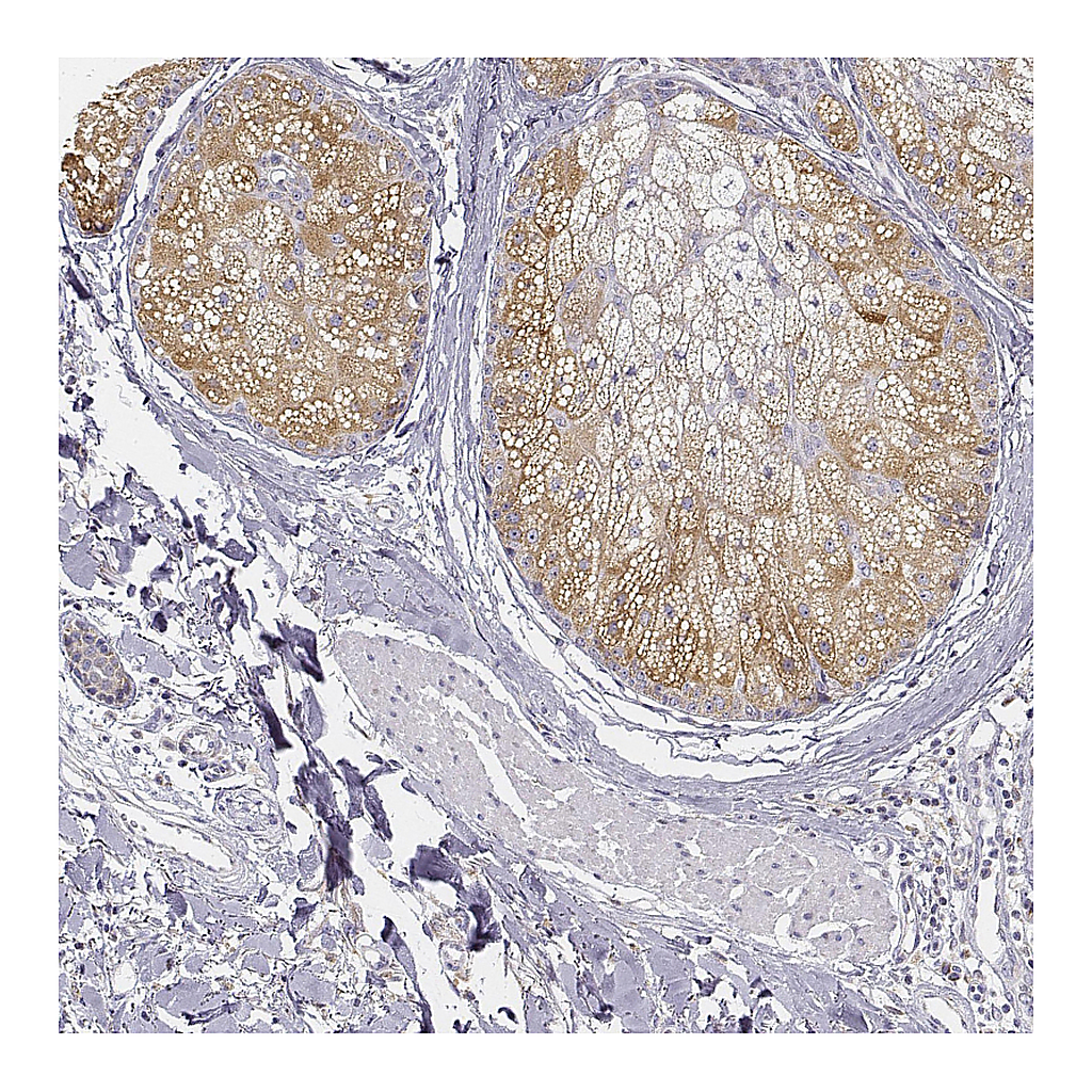 Atlas Antibodies Anti-AWAT2 Antibody