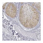 Atlas Antibodies Anti-AWAT2 Antibody