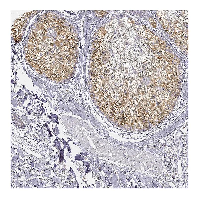 Atlas Antibodies Anti-AWAT2 Antibody