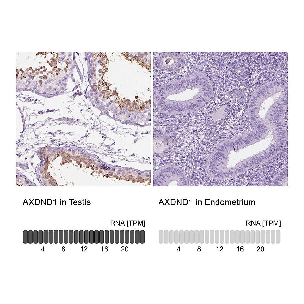 Atlas Antibodies Anti-AXDND1 Antibody