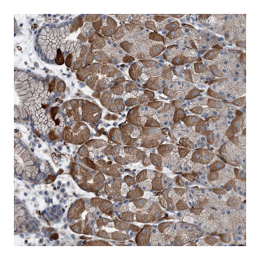 Atlas Antibodies Anti-AXL Antibody