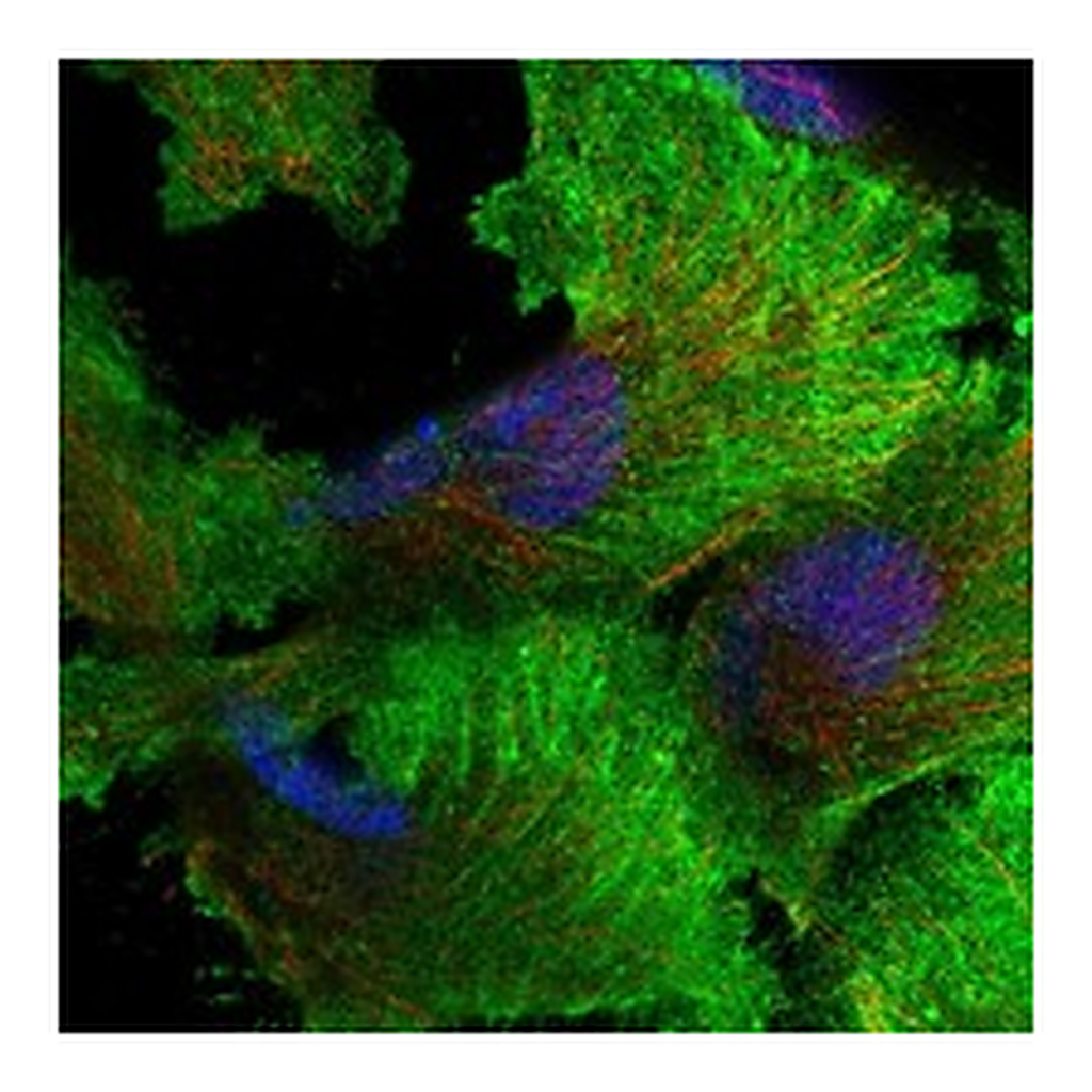 Atlas Antibodies Anti-AXL Antibody