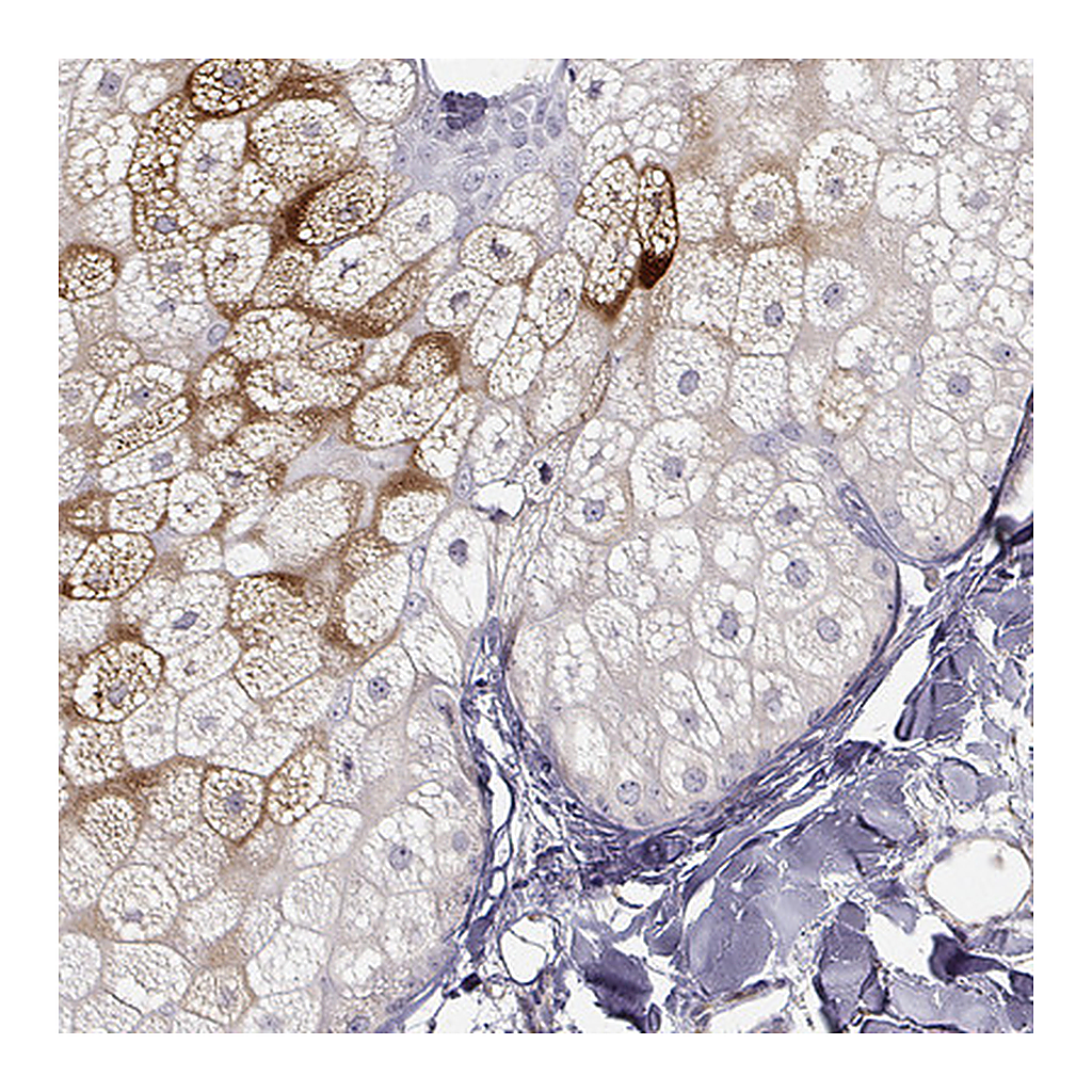 Atlas Antibodies Anti-AWAT1 Antibody