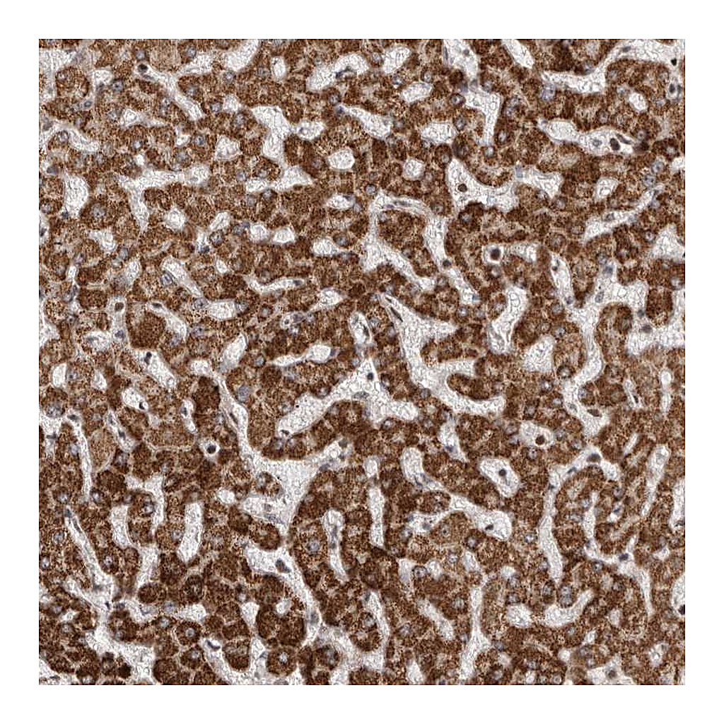 Atlas Antibodies Anti-AZIN1 Antibody