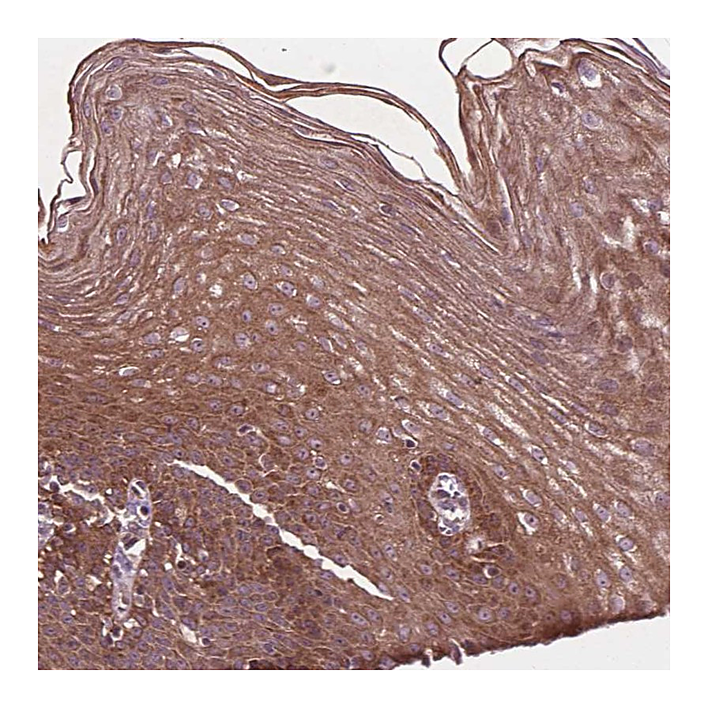Atlas Antibodies Anti-B3GALNT2 Antibody