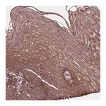 Atlas Antibodies Anti-B3GALNT2 Antibody