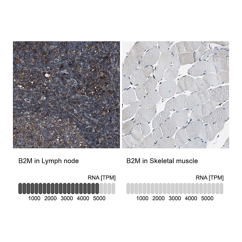Atlas Antibodies Anti-B2M Antibody