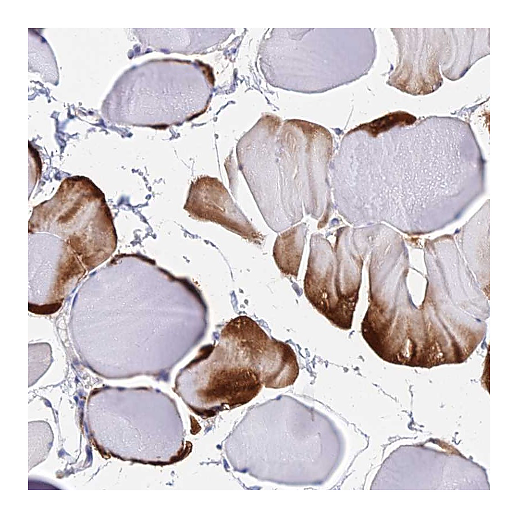 Atlas Antibodies Anti-B3GALT4 Antibody